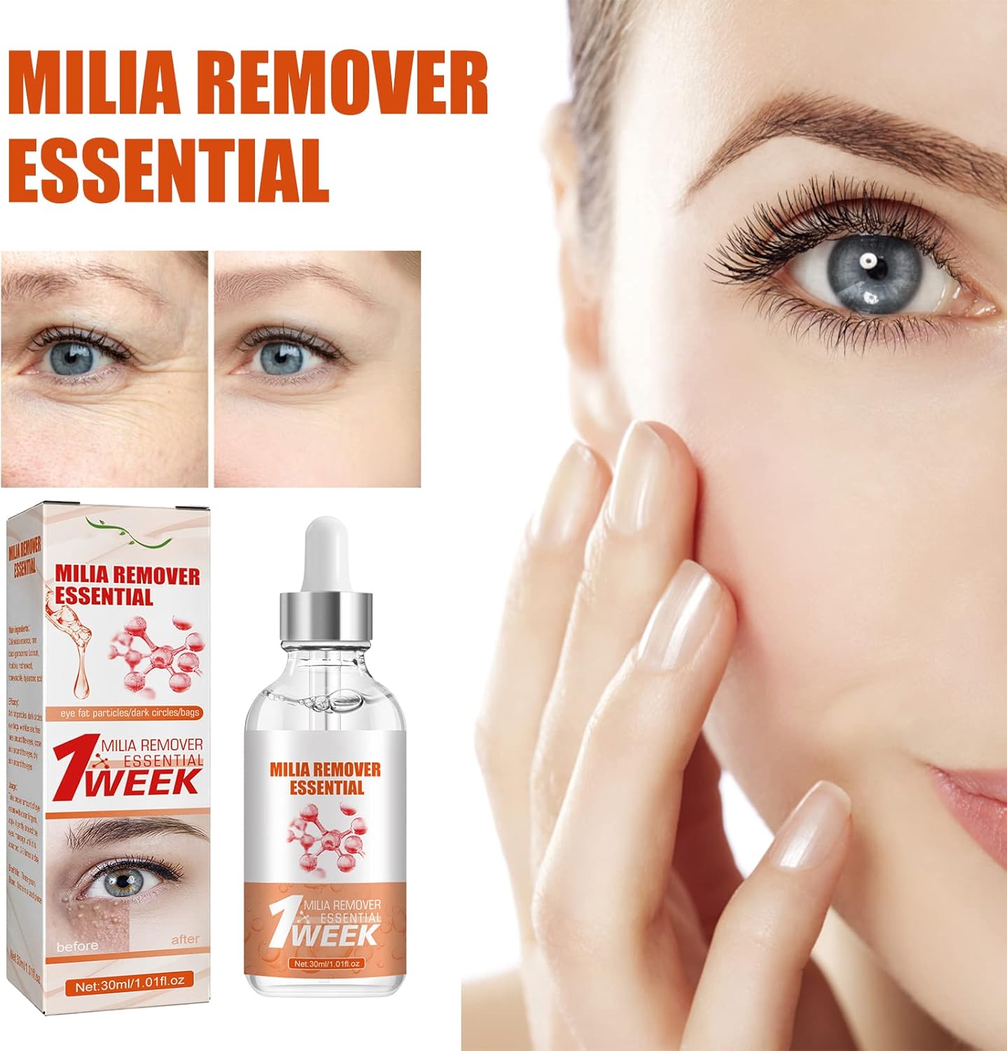 Smooth Milia Remover Serum (30ml)